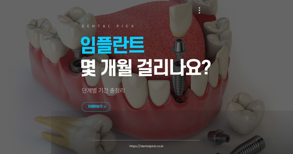 임플란트 몇 개월 걸리나요? 단계별 기간 총정리