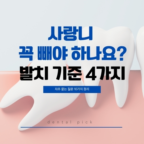 사랑니 모형 이미지와 함께 사랑니 꼭 빼야 하나요 발치 기준 4가지 텍스트가 담긴 치과 정보 썸네일 이미지
