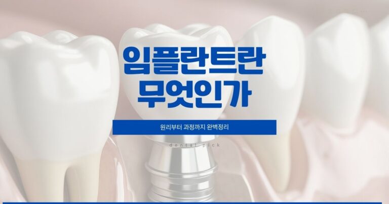 임플란트란 무엇인지 원리와 치료 과정을 설명하는 치과 정보 이미지