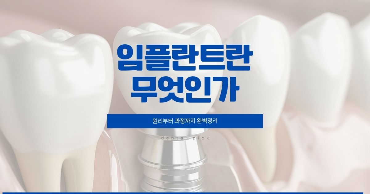 임플란트란 무엇인지 원리와 치료 과정을 설명하는 치과 정보 이미지