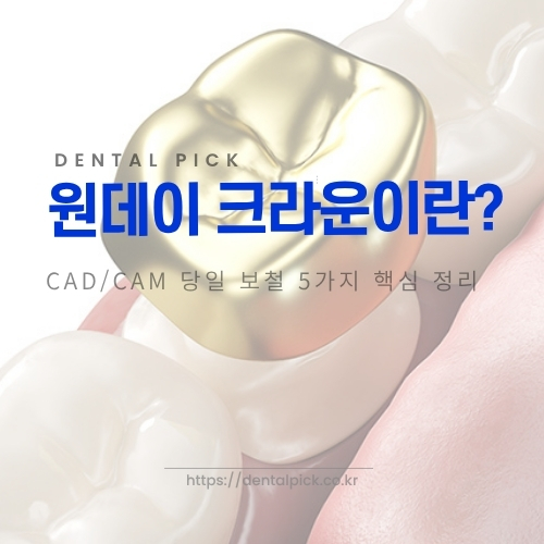 원데이 크라운 CAD/CAM 당일 보철 안내 이미지